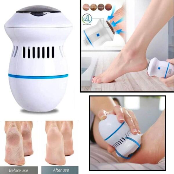 Rechargeable electric foot file for heel care