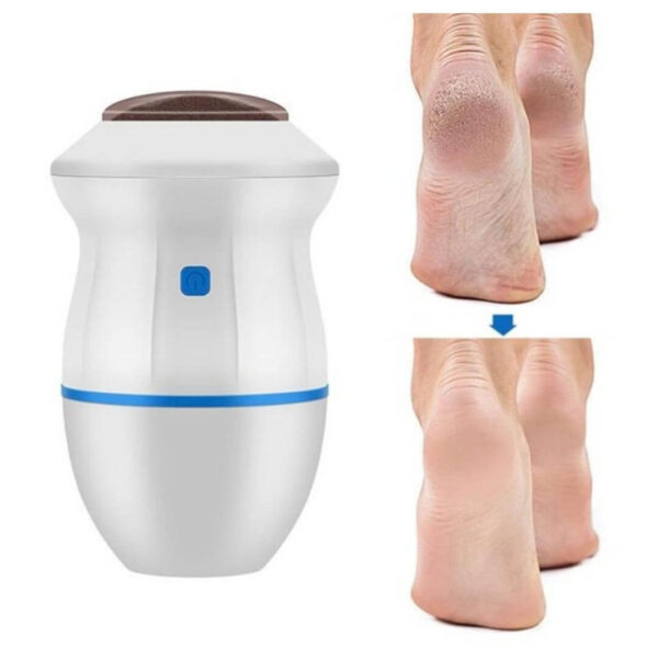 USB charging foot callus remover